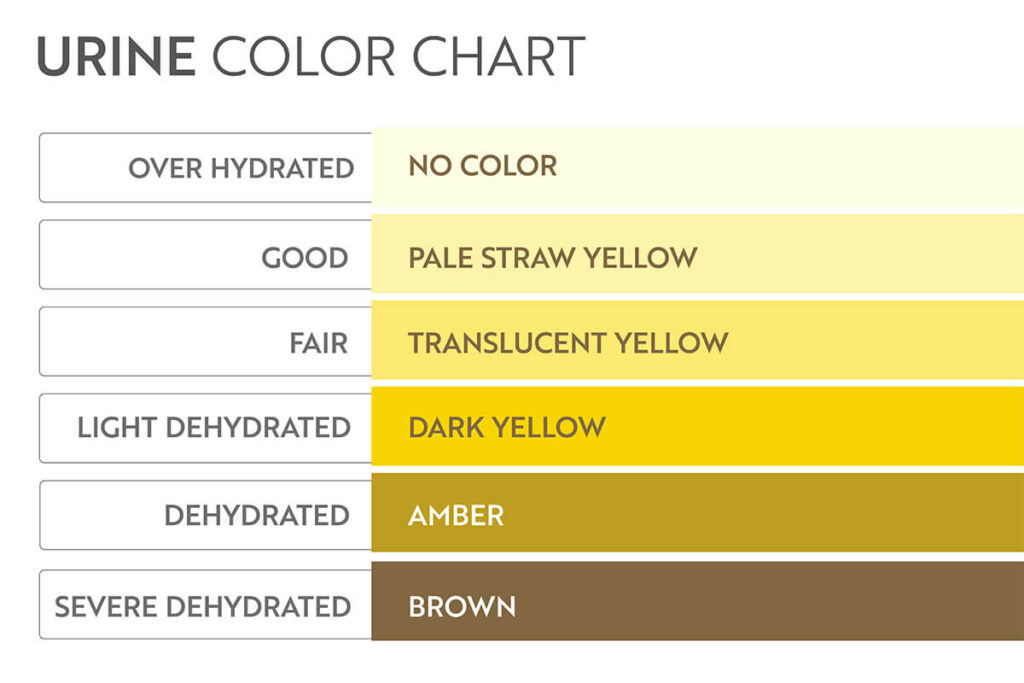 Urine color Chart